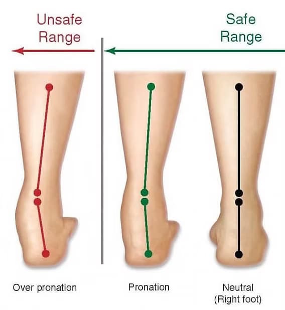 över pronation
