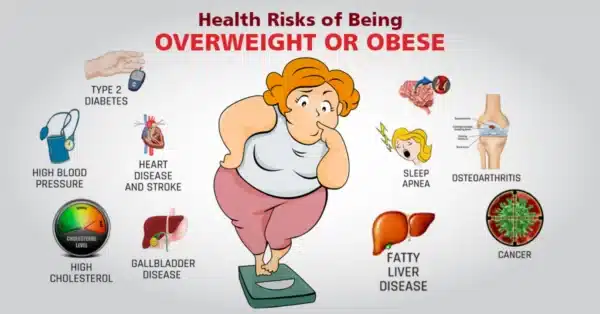 BMI 